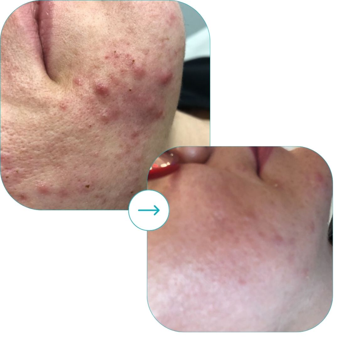 before and after med spa fort pierce8